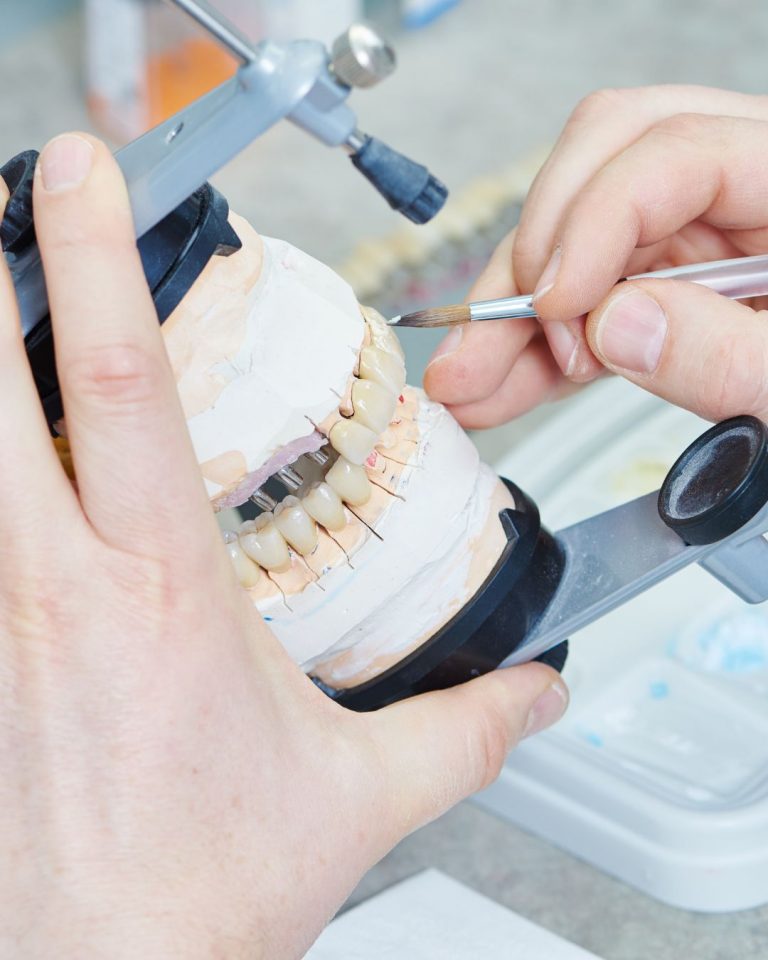 Lee más sobre el artículo La evolución digital de los laboratorios de prótesis dentales: un antes y un después